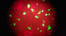 In this Feb. 26, 2015 photo taken through the eyepiece of a microscope, human cells infected with the flu virus glow green under light from a fluorescence microscope at a laboratory in Seattle. 