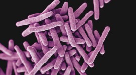  A 3-D, computer-generated image of drug-resistant, Mycobacterium tuberculosis bacteria, the pathogen responsible for causing the tuberculosis disease. 