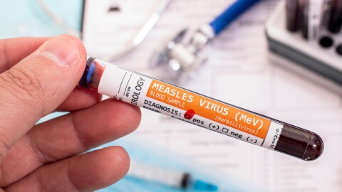 Blood samples with infected measles virus, with stethoscope, mask and syringe and other stuff.