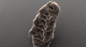 A Tardigrade, also known as water bear due to its shape under a microscope, possess superpowers when it comes to surviving really harsh conditions.