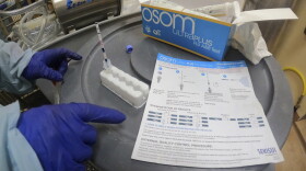 In this image provided by the U.S. Department of Agriculture via the AP, a researcher performs a rapid antigen test on milk from a dairy cow inoculated against bird flu in a containment building at the National Animal Disease Center research facility in Ames, Iowa, on Monday, July 29, 2024.