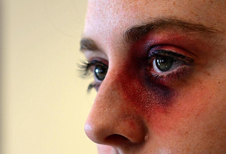 Locally the number of gender-based violence cases are increasing. It's unclear if there are more incidents or if victims are reporting them more frequently.