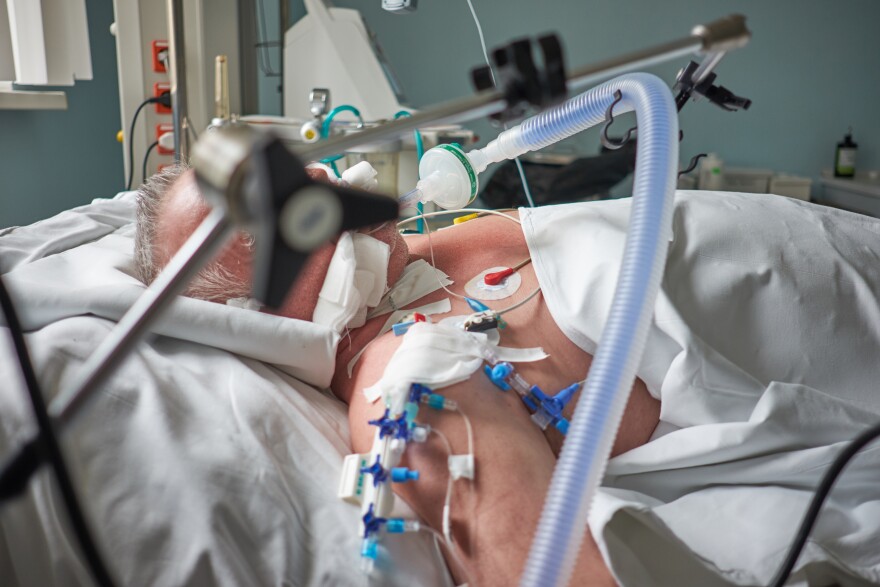 An intubated man on a ventilator in the ICU. State health officials are requesting some 200 ventilators from the federal stockpile to help with the current surge and record numbers of hospitalized COVID patients.