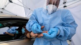 People sit in their car as health care workers draw their blood at the Southside Church of Christ in Los Angeles, California, on January 18, 2021 as free rapid Covid-19 antibody and PCR tests are administered to local residents.