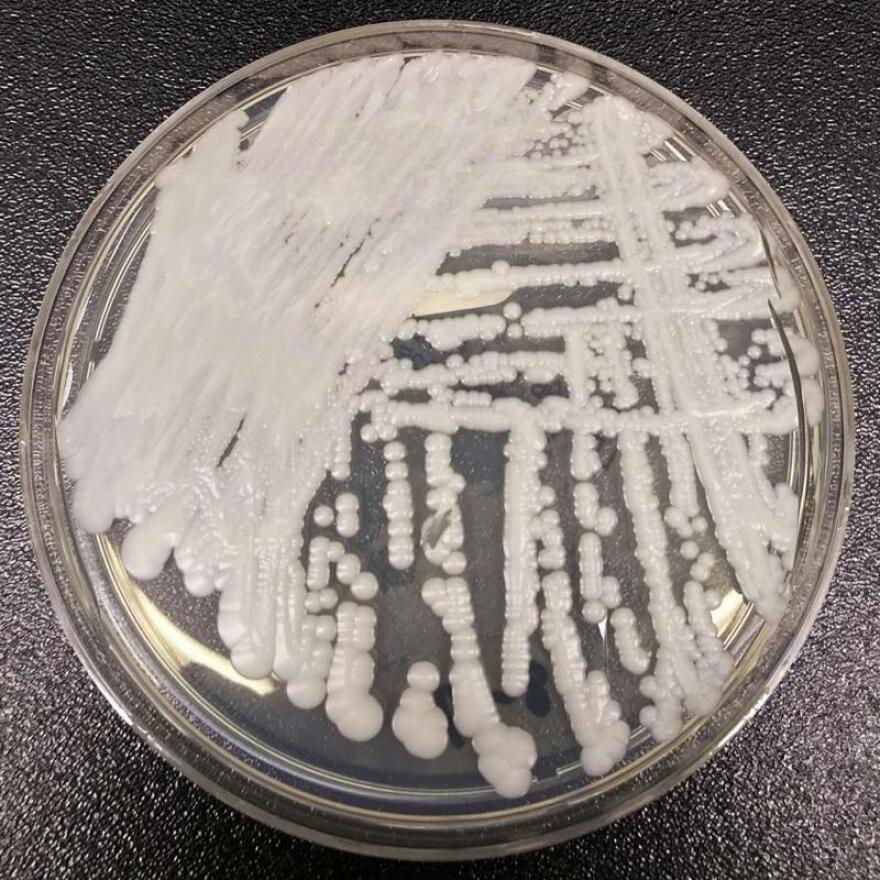 A strain of the fungus Candida auris shown in a petri dish.