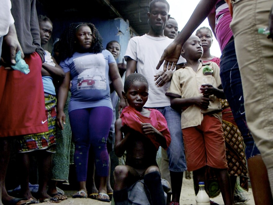 Saah Exco puts on a shirt after neighbors in Liberia's West Point found him on the beach.