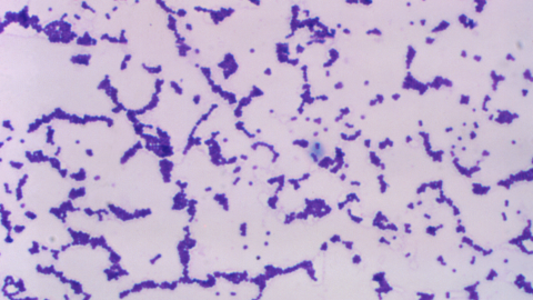 A view of the enterococcus bacteria under a high-powered microscope