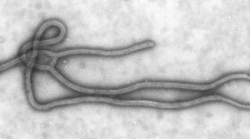 The Ebola Virus as viewed through a transmission electron micrograph.