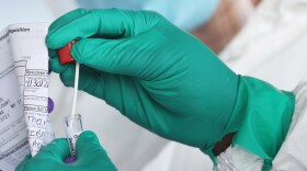 The majority of people likely infected with the omicron variant of COVID-19 were unaware, according to a study from a medical center in Los Angeles, Calif.