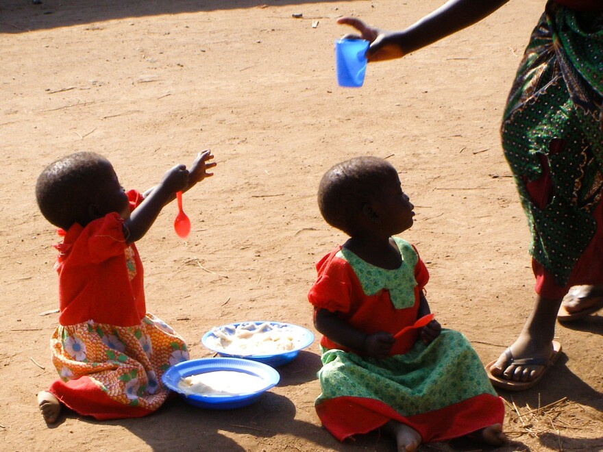 Twins in Malawi helped scientists discover a role the gut microbiome appears to play in severe malnutrition.