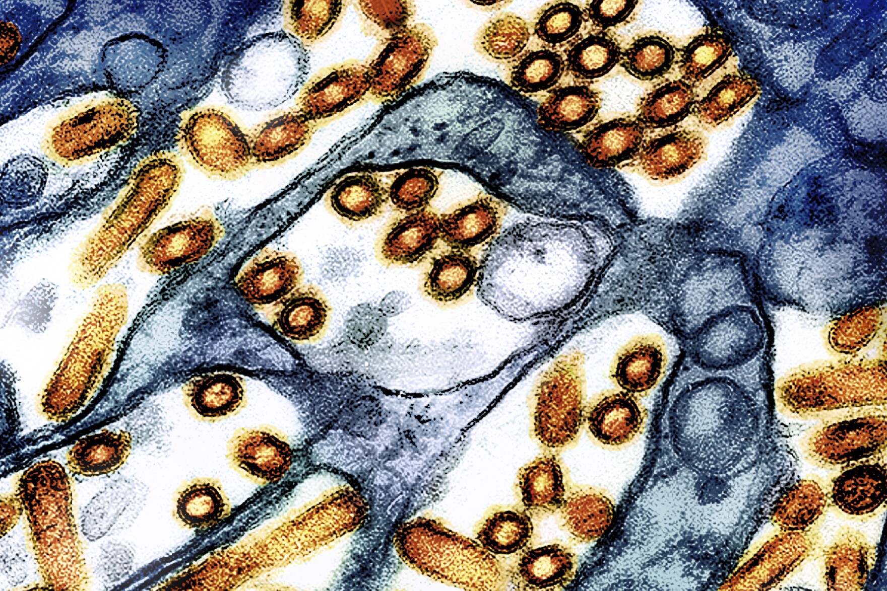 Low levels of bird flu detected in wastewater samples on Kauaʻi Hawai