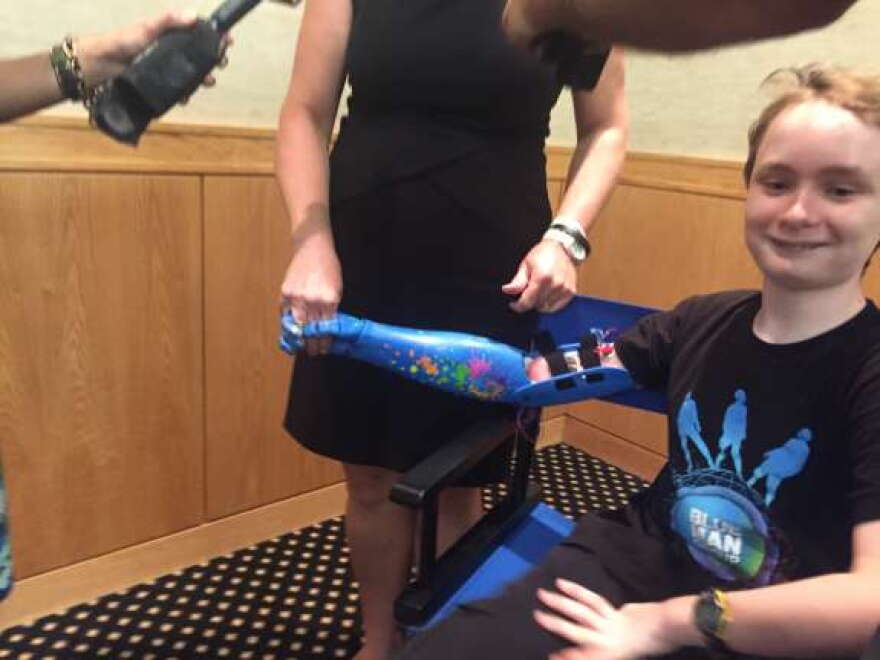 Wyatt Falardeau got a Blue Man Group bionic arm from Limbitless Solutions, a UCF nonprofit.