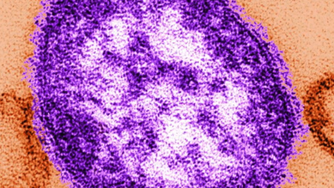 This undated image made available by the Centers for Disease Control and Prevention on Feb. 4, 2015 shows an electron microscope image of a measles virus particle, center. 