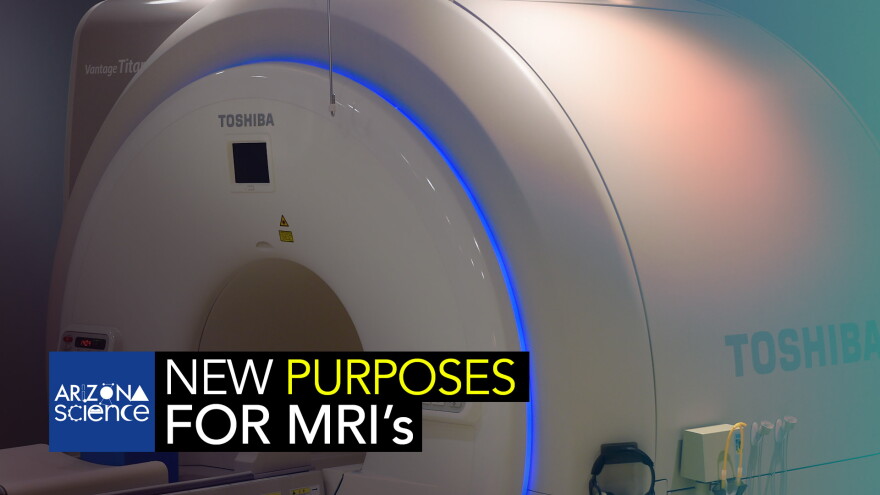 AZSCI 148 MRI
