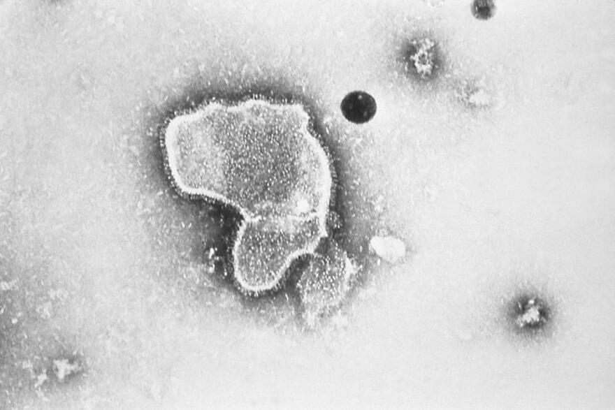  This 1981 photo provided by the Centers for Disease Control and Prevention shows an electron micrograph of Respiratory Syncytial Virus, also known as RSV. Children's hospitals in parts of the country are seeing a distressing surge in RSV, a common respiratory illness that can cause severe breathing problems for babies. 