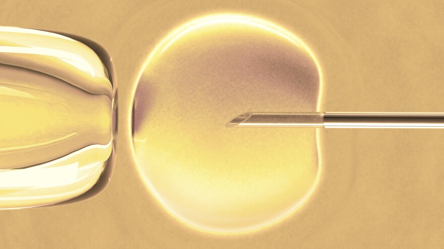 Sperm are placed inside the egg with a needle during a fertility treatment called intracytoplasmic sperm injection.