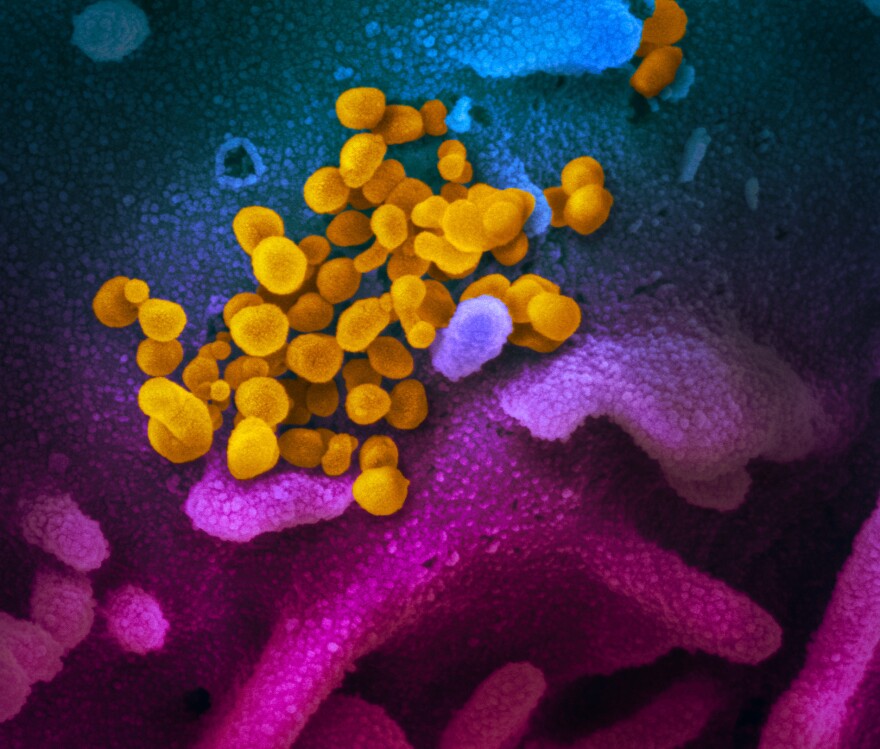 This scanning electron microscope image shows SARS-CoV-2 (in yellow) — the coronavirus that causes COVID-19 — isolated from a patient in the U.S., emerging from the surface of cells (in blue/pink) cultured in a lab. (National Institute of Allergy and Infectious Diseases - Rocky Mountain Laboratories)