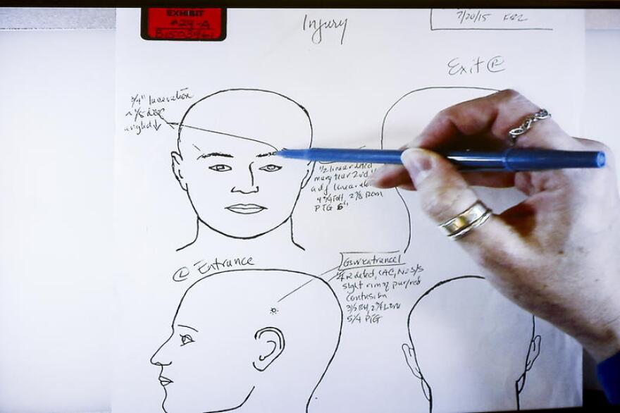 drawings of Dubose autopsy