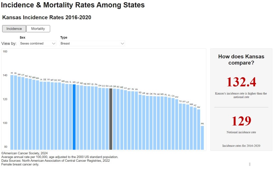 A graph showing incidence rates of breast cancer.