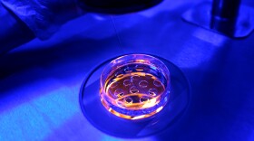 Laboratory researcher injecting fluid into a petri dish with embryos conducting research of genetic material under a microscope.