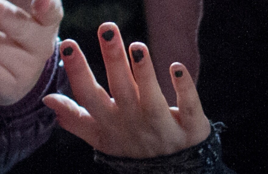 Nail close-up showing ragged manicure