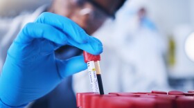 A lab worker holds a vial of blood 