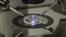 An embryologist works on a petri dish. (Sang Tan/AP)