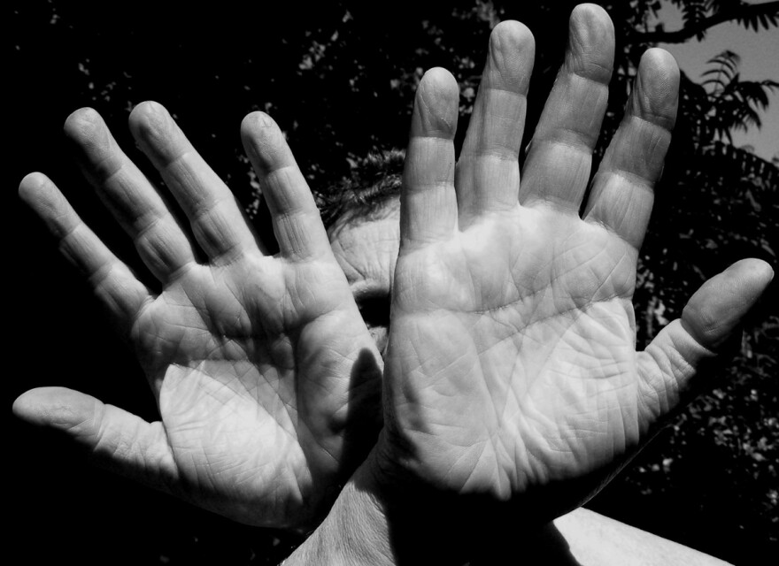 The palms of your hands, soles of your feet, and your lips are examples of thick skin.