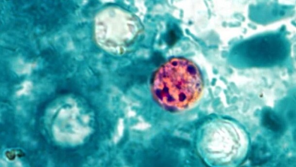 The CDC has officially confirmed over 800 cases of cyclosporiasis, a disease that causes severe diarrhea from ingesting contaminated water or produce.