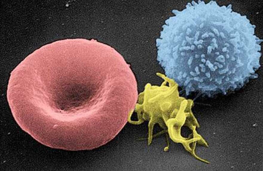 Scanning electron micrograph of T lymphocyte (right), a platelet (center) and a red blood cell (left).