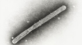 This 2005 electron microscope image shows an avian influenza A H5N1 virion. On Wednesday, May 22, 2024, Michigan health officials said a farmworker has been diagnosed with bird flu, the second human case connected to an outbreak in U.S. dairy cows. (Cynthia Goldsmith, Jackie Katz/CDC via AP)