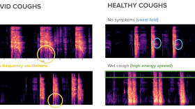 Images from researchers at Cambridge University show how algorithms look for signs of COVID-19 in audio samples of coughs. (Courtesy of Dimitris Spathis)