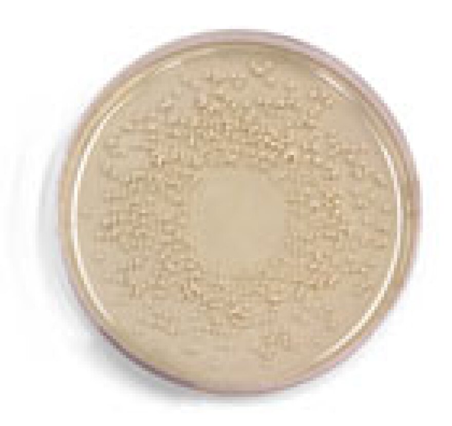A petri dish with bacteria colonies. hspace=2