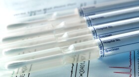 Family medical histories are used to figure out whether it is worthwhile for a woman to be tested for BRCA genetic mutations, which increase the risk of breast and ovarian cancer.