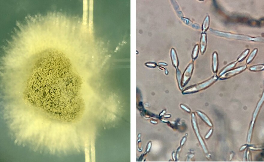 Cladosporium colonies emerge from a Twinkie sample (left) and viewed at 20 times magnification using a compound microscope.