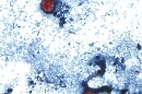 A microscope photo Cyclospora cayetanensis oocysts found in a fresh stool sample 