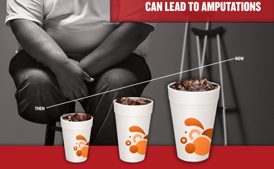 A New York City Department of Health campaign promoting portion control depicts an amputee. But is he really?