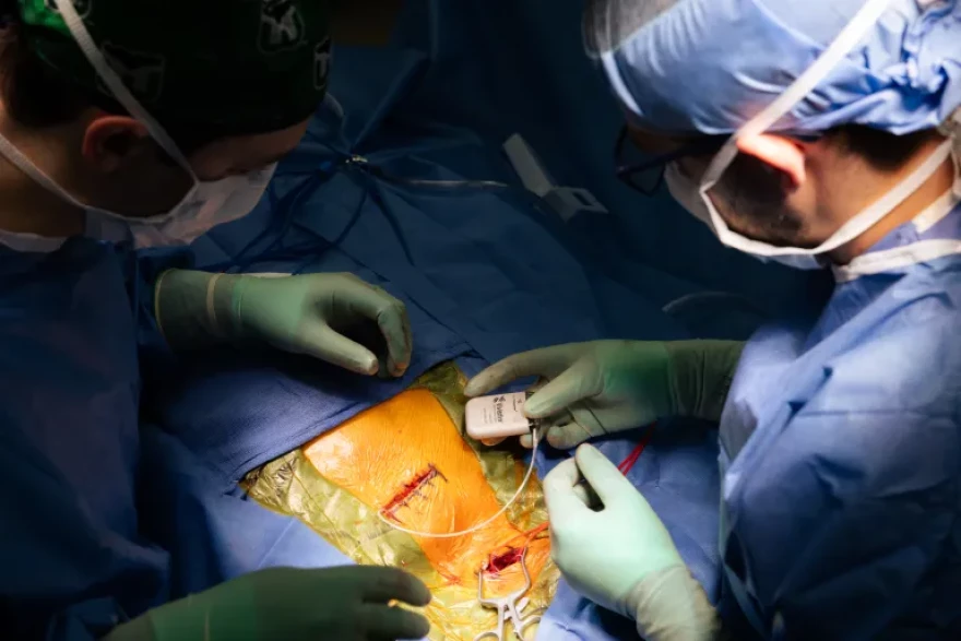 Physician assistant Will Kelsey hands a Vivistim device to Dr. Christopher Conner during a procedure in March