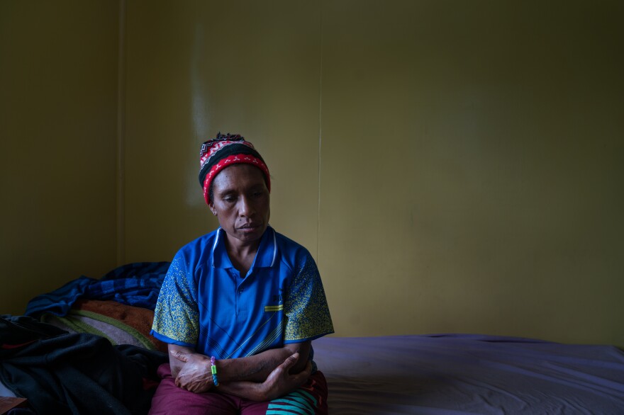 Margaret Kambao, a divorced mother of four, lives with her younger children at a safe house in Goroka. In 2015, she was accused of sorcery and tortured by members of her community in Enga Province. The mob stripped her naked, tied her hands and pushed her onto a corrugated metal roof that had been heated in a bonfire. Her skin was burned, leaving deep scars.