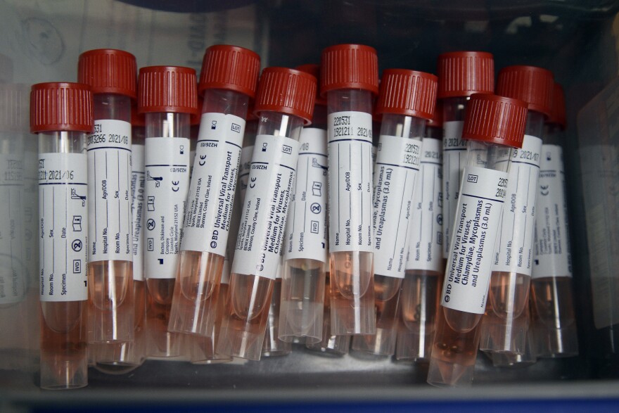 coronavirus_test_tubes_testing.jpg