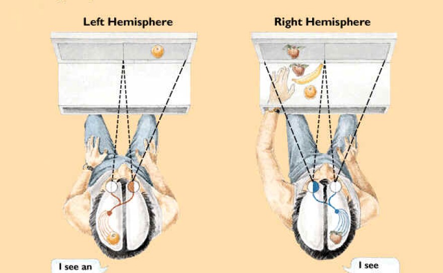 Split-brain studies have illuminated how the brain functions and raised bigger philosophical questions like: what is a mind, and what would it mean to have two minds?