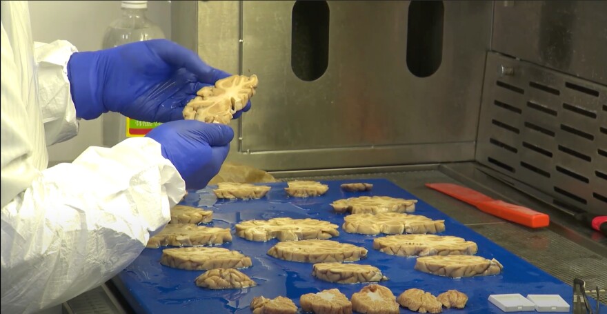 A scientist works with brain slices as part of his research.