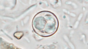 Missouri Reports Nearly 600 Cases of Cyclospora Illness Amidst National Outbreak Investigation