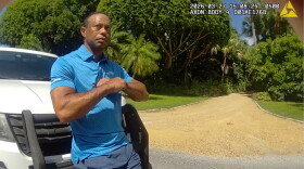 Tiger Woods in a blue polo shirt performs a field sobriety test while leaning on a white SUV 