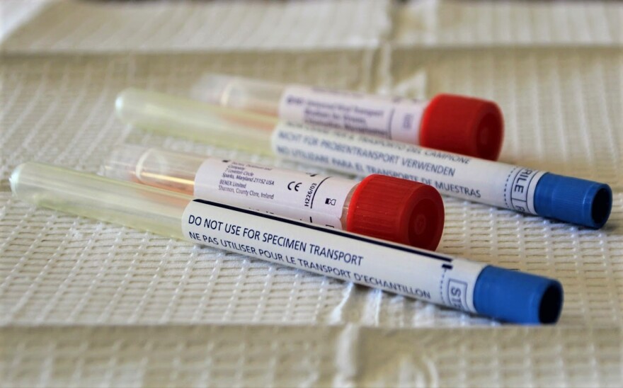 Missouri Will End At Home Covid Testing Program Just A Few Months After Promoting It Kcur 3 Npr In Kansas City Missouri Will End At Home Covid Testing Program Just A Few Months After Promoting It Kcur 3 Npr In Kansas City