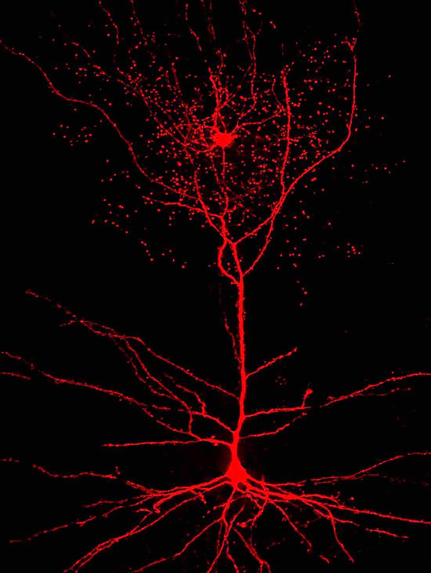 An image of a rosehip neuron (top) and a connecting pyramidal cell (bottom).