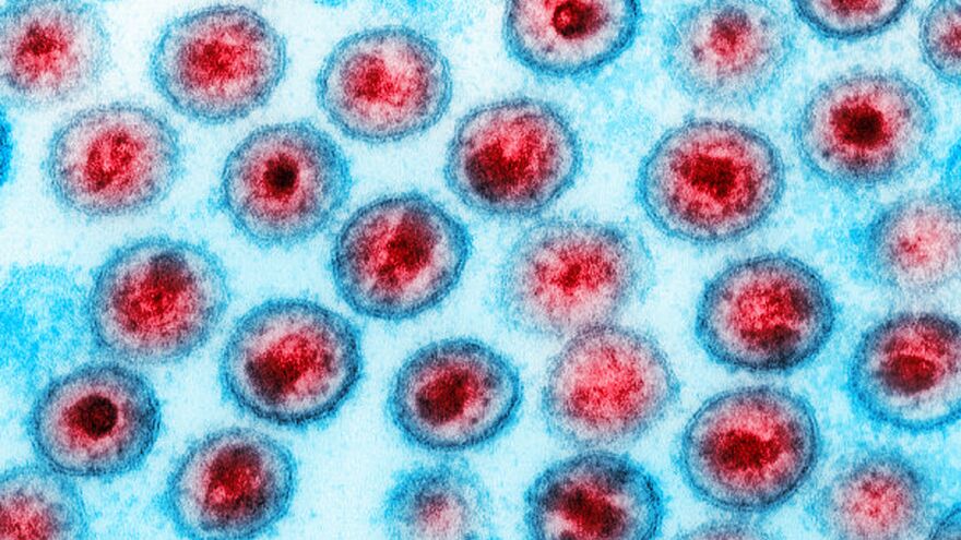 Callista Images/Getty Images/Image Source