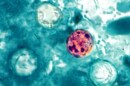 A view of a red blob with dark specs under a microscope lens, surrounded by various shades of blue and white.
