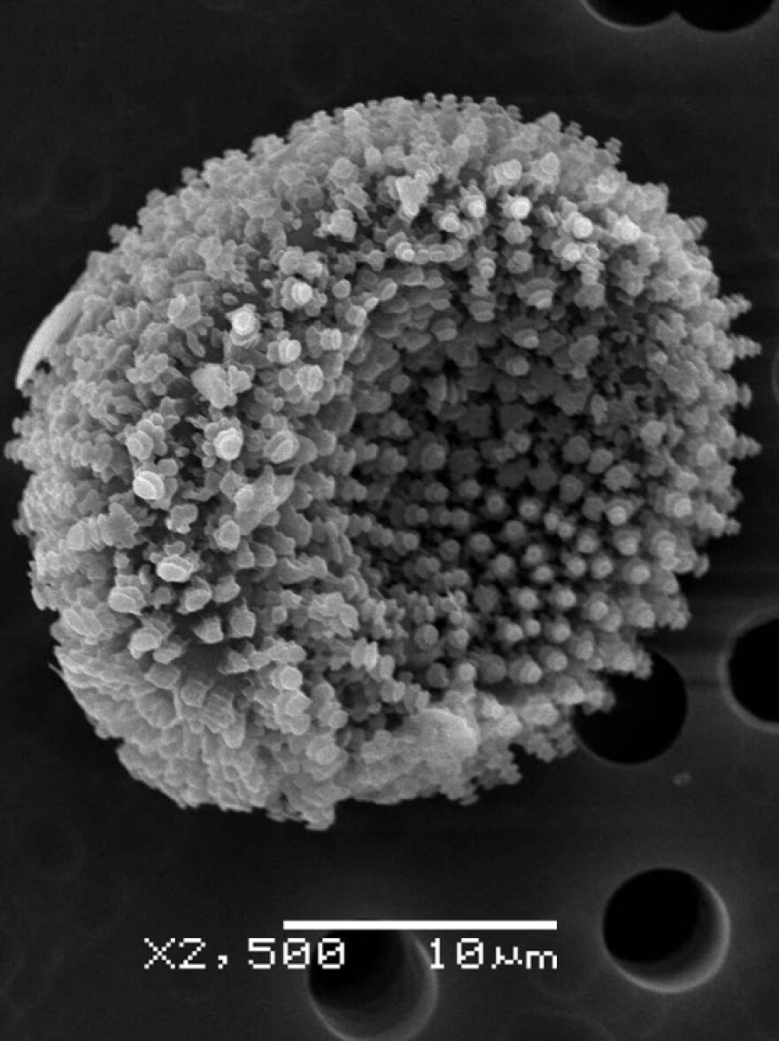 A single "uredo"-spore from the Alaskan sample, as seen in a closeup via scanning electron microscope.