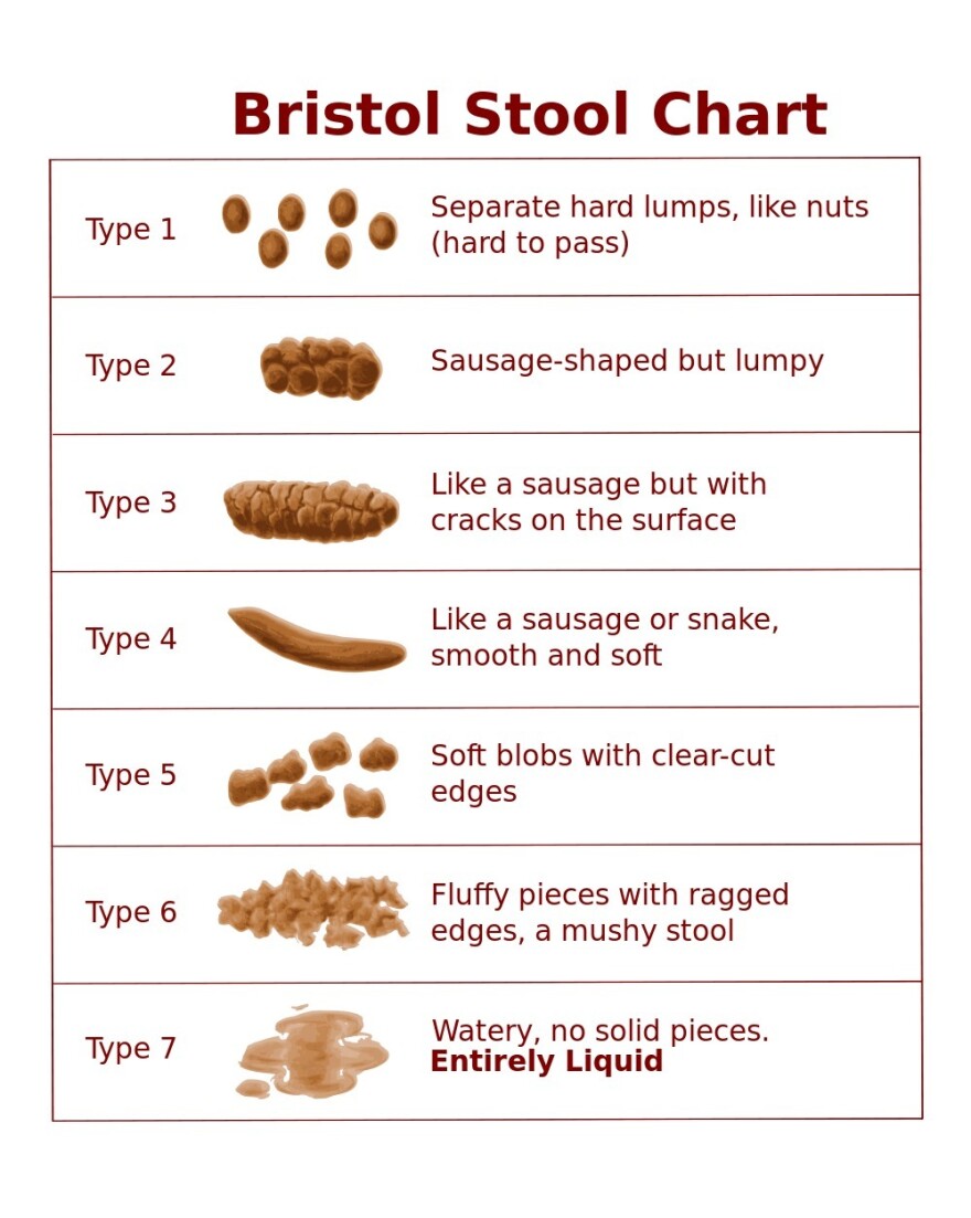 The Bristol stool chart was developed by Dr. Ken Heaton at the University of Bristol and first published in 1997.